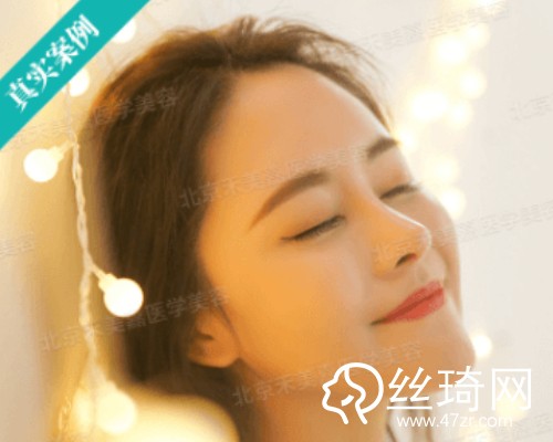 北京禾美嘉醫(yī)療美容自體脂肪填充面部那個醫(yī)生好？