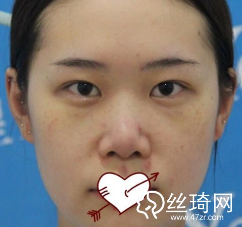 成都恒博醫(yī)院李烈醫(yī)生怎么樣？