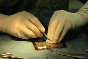 玻尿酸隆鼻也有被嫌棄的時候，你該怎么選?