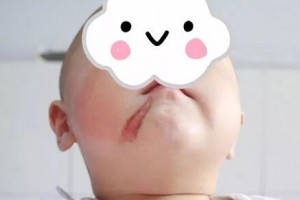 如果臉上或身上長(zhǎng)有各種黑痣，人們往往會(huì)稱他們?yōu)椤坝叙肭嗄辍?