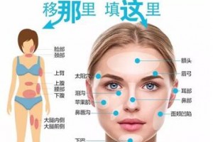 自體脂肪填充，將脂肪變廢為寶！自體脂肪的成活率高嗎