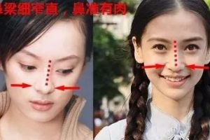 豐厚大鼻子、多肉細(xì)窄鼻子、獅子鼻、希臘鼻各是什么意思
