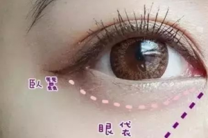 這3個溝不解決，永遠顯老！
