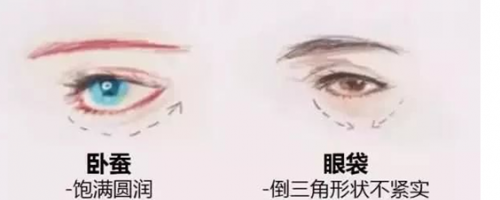 玻尿酸注射『臥蠶』，你需要嗎？