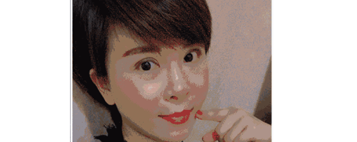 深圳藝星整形醫(yī)生常德成：她脂肪填充后，臉居然變小了？