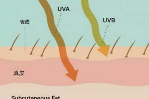 深圳藝星整形醫(yī)生王明海：為什么有些人夏天曬不黑？而你一曬就黑…
