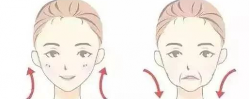 【法令紋】玻尿酸VS埋線提升，去法令紋到底哪個好？