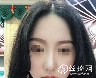 蘭州皙妍麗醫(yī)療美容整形門診部做的瘦臉術(shù)價格表