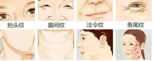 為什么有人看上去永遠(yuǎn)像18歲？