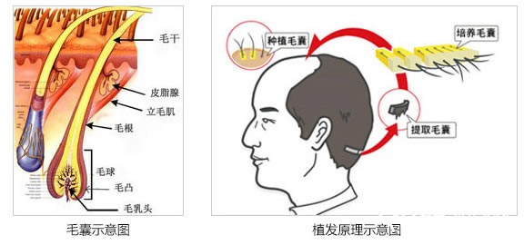 安徽維多利亞毛發(fā)種植中心植發(fā)原理