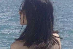 深圳明倫整形美容醫(yī)院整形價格表(價目表)2020全新發(fā)布