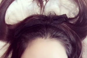 腿部吸脂了解一下！