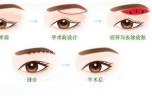 什么是提美術