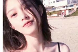 武警上?？傟犪t(yī)院整形美容中心周志綱整形價格表附雙眼皮案例展示