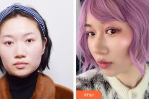 上海韓志強醫(yī)療美容外科韓志強整形價格表附雙眼皮案例展示