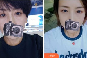上海清楊整形外科門(mén)診部張濱整形價(jià)格表附祛眼袋案例展示