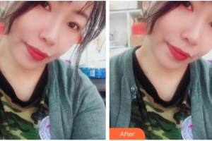 上海新形象整形外科門(mén)診部劉岱良整形價(jià)格表附臉頰面部填充案例展示