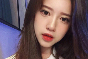 南京鳳凰島整形美容醫(yī)院王影整形價格表附眼部綜合案例展示