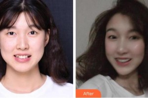 上?？仆呖谇婚T診部季愛萍整形價格表附隱形托槽矯正案例展示