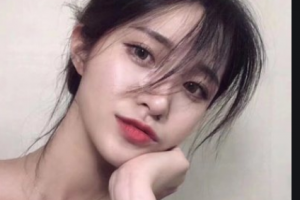 南京金臺口腔門診部王永整形價格表附隱形托槽矯正案例展示