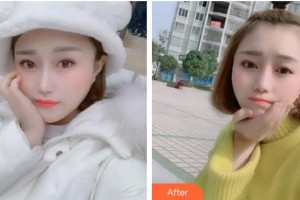 上海維樂口腔門診部邱夢(mèng)珍整形價(jià)格表附牙齒金屬矯正案例展示