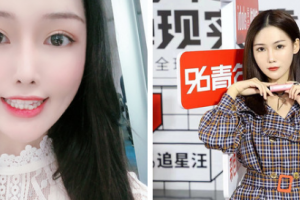 南京博韻口腔門(mén)診部丁冬梅整形價(jià)格表附金屬托槽矯正案例展示
