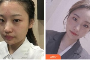 成都素美醫(yī)療美容診所范瓅月整形價(jià)格表附超激光美膚祛斑嫩膚案例展示