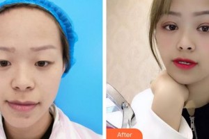 成都明星醫(yī)療美容門診部于海成整形價格表附眼部手術案例展示