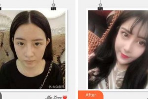 成都圣形醫(yī)療美容診所陳強(qiáng)整形價格表附眼部整形案例展示