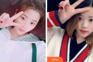 成都純?？谇辉\所馬華鈺整形價格表附冷光美白案例展示
