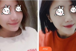 福建武警總隊(duì)醫(yī)院激光美容中心?？溯x整形價(jià)格表附無(wú)針?biāo)獍咐故?>
</a>
<h3 class=