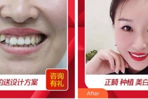 廈門卓爾口腔門診部蘇煉強整形價格表附隱形矯正案例展示