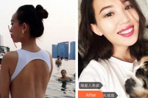 廈門(mén)峰煜口腔門(mén)診部林光毅整形價(jià)格表附牙齒矯正案例展示