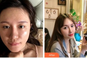 莆田維納斯整形美容門(mén)診部時(shí)慧整形價(jià)格表附埋線(xiàn)提升案例展示