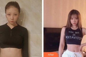 漳州市醫(yī)院整形美容科許和平整形價(jià)格表附疤痕案例展示