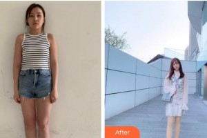 漳州市第三醫(yī)院整形美容中心樂通城整形價(jià)格表附大象腿怎么變成筷子腿案例展示