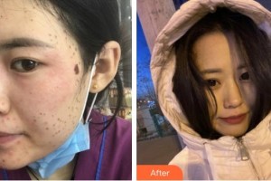 漳州美博士醫(yī)療美容門診部易欣整形價(jià)格表附超激光美膚祛斑案例展示