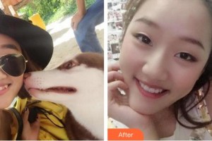 漳州南健口腔門診部林藝妹整形價(jià)格表附牙齒隱形矯正案例展示