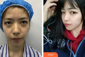 安徽韓美整形美容醫(yī)院張蓓蕾整形價格表附激光美膚祛斑案例展示