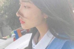 深圳南方門診激光整形美容中心王永祥整形價(jià)格表附埋線提升案例展示