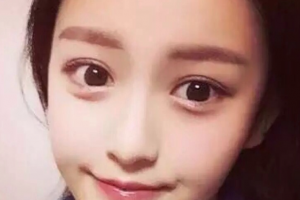 長(zhǎng)沙臻顏醫(yī)療美容門診部張浩整形價(jià)格表附激光祛斑案例展示