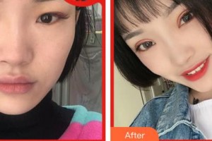 合肥愛爾眼科醫(yī)院王紅巖整形價格表附眼部綜合案例展示