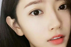 長(zhǎng)沙真愛(ài)整形美容醫(yī)院陳詠玲整形價(jià)格表附光子嫩膚案例展示