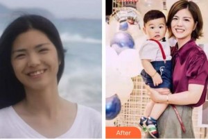 宣城為民口腔門(mén)診部王縱波整形價(jià)格表附牙齒隱形矯正案例展示