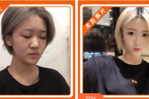 浙江大學醫(yī)學院附屬第二醫(yī)院整形科許鳳芝整形價格表附鼻部綜合案例展示