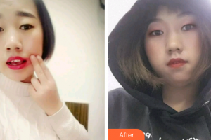 廣州市荔灣區(qū)口腔醫(yī)院魏彤整形價格表附牙齒根管調(diào)節(jié)案例展示