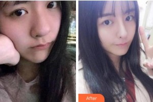 杭州君曼醫(yī)療美容會(huì)所黃君曼整形價(jià)格表附熱瑪吉案例展示