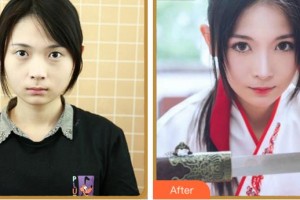 杭州朝聚眼科醫(yī)院張鑫整形價格表附眼部綜合案例展示
