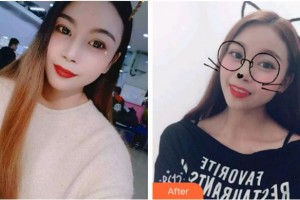 杭州亮貝美口腔醫(yī)院李詩(shī)佩整形價(jià)格表附牙貼面案例展示