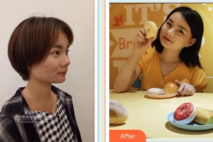 寧波千口百惠口腔門診部程海標整形價格表附牙齒隱形矯正案例展示
